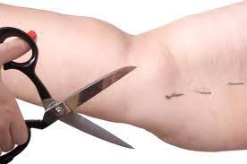 cutting arm fat